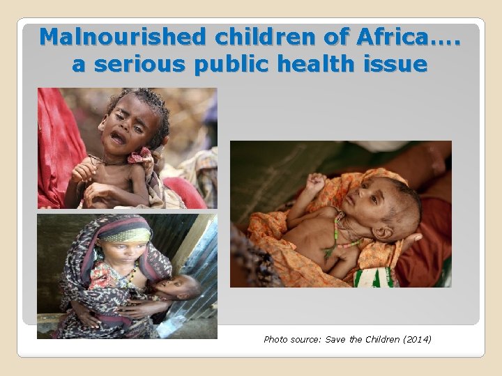 Malnourished children of Africa…. a serious public health issue Photo source: Save the Children