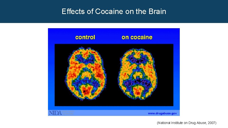 Effects of Cocaine on the Brain (National Institute on Drug Abuse, 2007) 