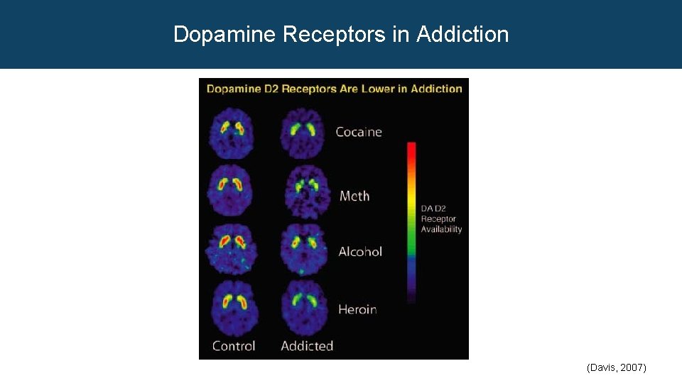 Dopamine Receptors in Addiction (Davis, 2007) 