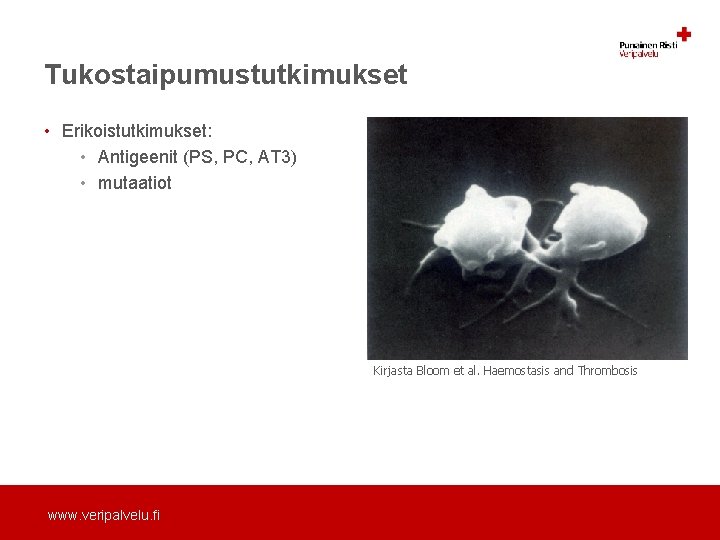 Tukostaipumustutkimukset • Erikoistutkimukset: • Antigeenit (PS, PC, AT 3) • mutaatiot Kirjasta Bloom et