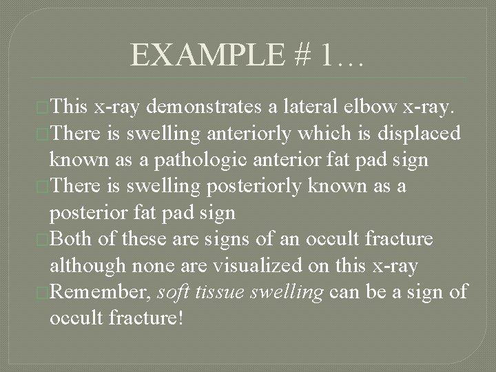 EXAMPLE # 1… �This x-ray demonstrates a lateral elbow x-ray. �There is swelling anteriorly