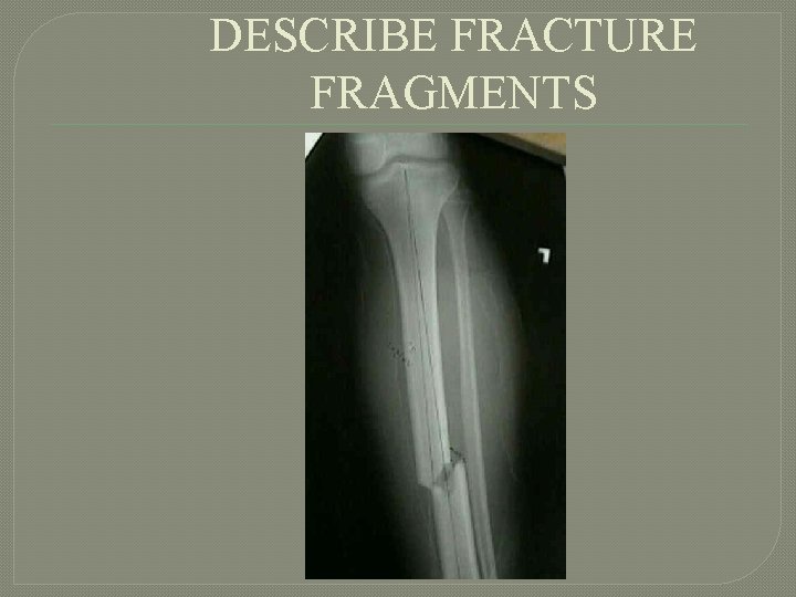 DESCRIBE FRACTURE FRAGMENTS 