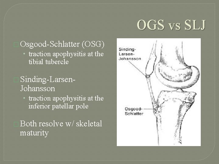 OGS vs SLJ � Osgood-Schlatter (OSG) • traction apophysitis at the tibial tubercle �