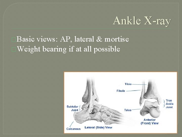 Ankle X-ray �Basic views: AP, lateral & mortise �Weight bearing if at all possible