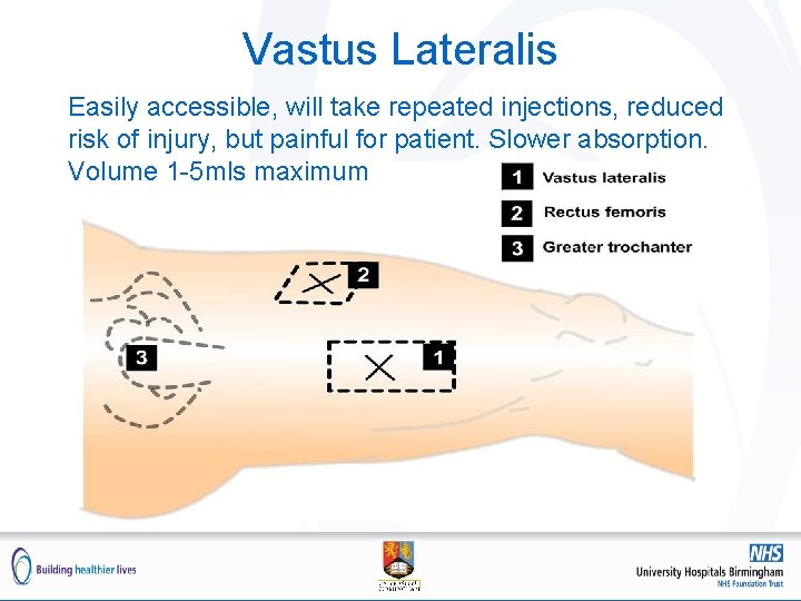 Vastus Lateralis Easily accessible, will take repeated injections, reduced risk of injury, but painful Vastus Lateralis Easily accessible, will take repeated injections, reduced risk of injury, but painful