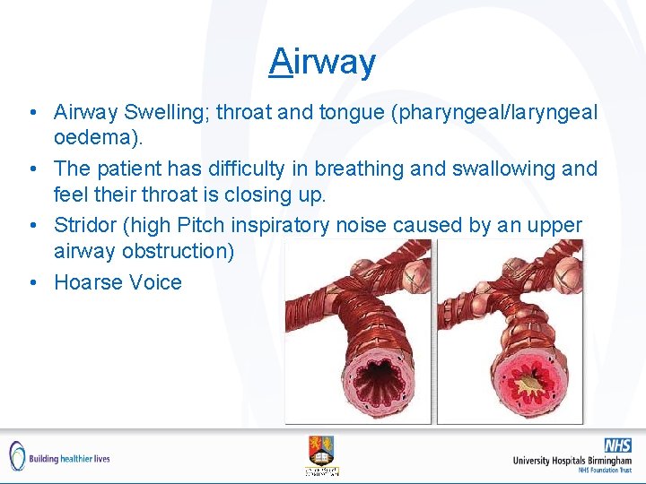 Airway • Airway Swelling; throat and tongue (pharyngeal/laryngeal oedema). • The patient has difficulty