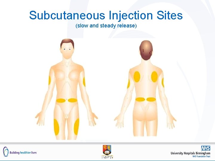 Subcutaneous Injection Sites (slow and steady release) 