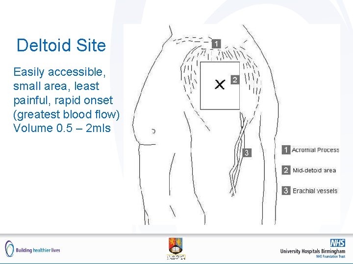 Deltoid Site Easily accessible, small area, least painful, rapid onset (greatest blood flow) Volume