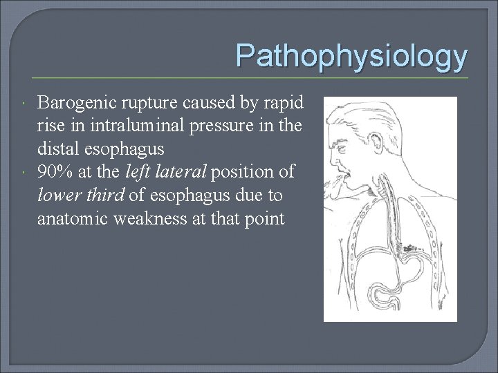 Pathophysiology Barogenic rupture caused by rapid rise in intraluminal pressure in the distal esophagus