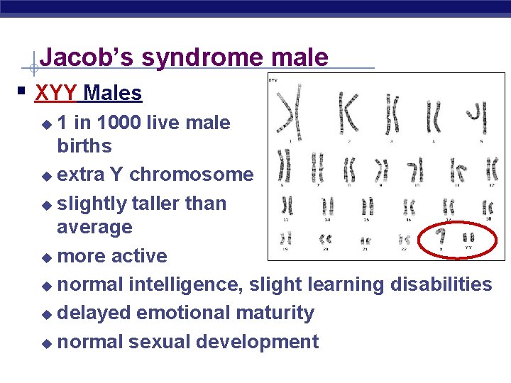 Jacob’s syndrome male § XYY Males 1 in 1000 live male births u extra