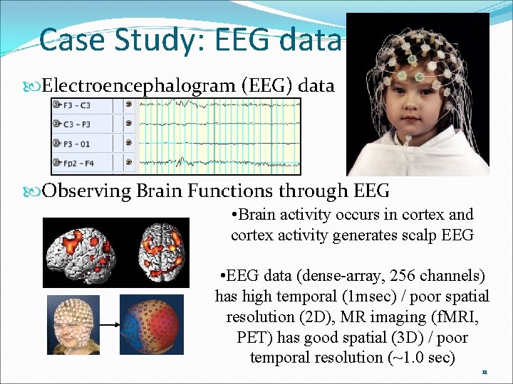 Case Study: EEG data Electroencephalogram (EEG) data Observing Brain Functions through EEG • Brain