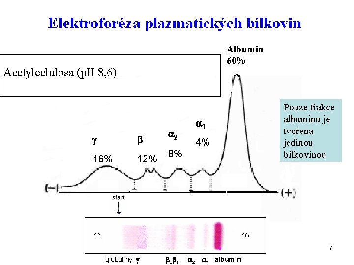 Elektroforéza plazmatických bílkovin Albumin 60% Acetylcelulosa (p. H 8, 6) 16% 12% 1 2