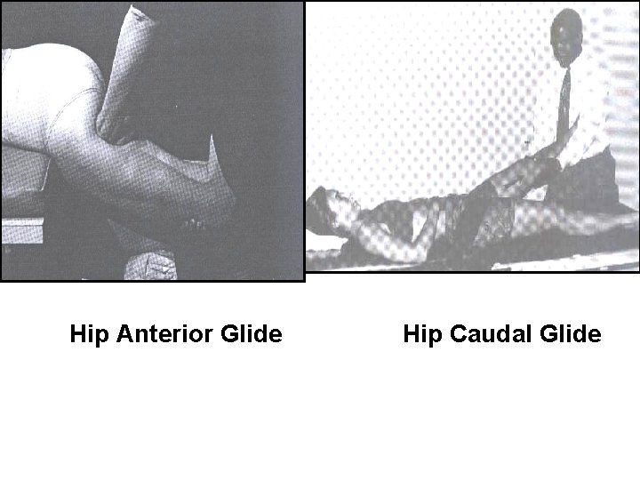 Hip Anterior Glide Hip Caudal Glide 