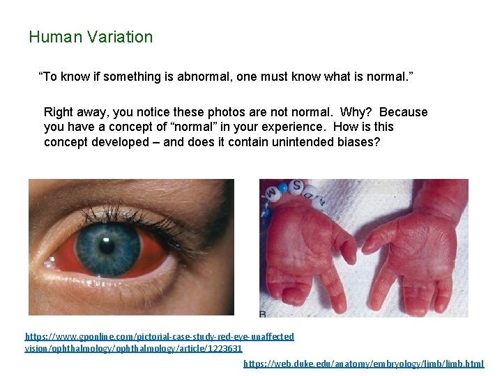 Human Variation “To know if something is abnormal, one must know what is normal.