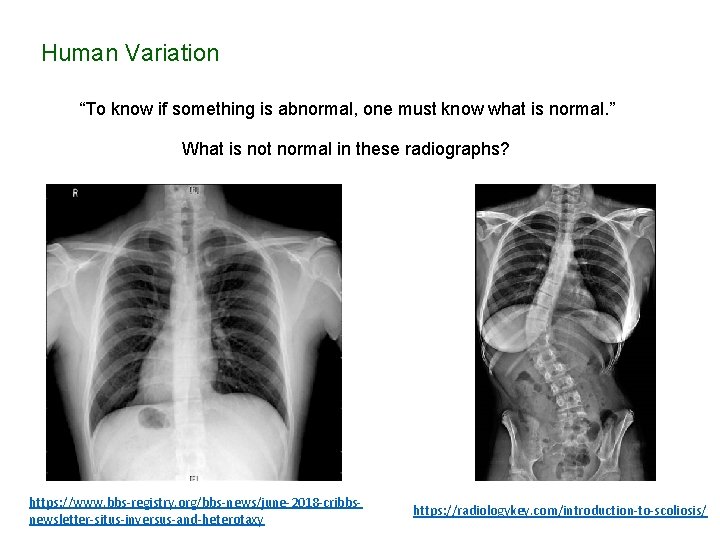 Human Variation “To know if something is abnormal, one must know what is normal.
