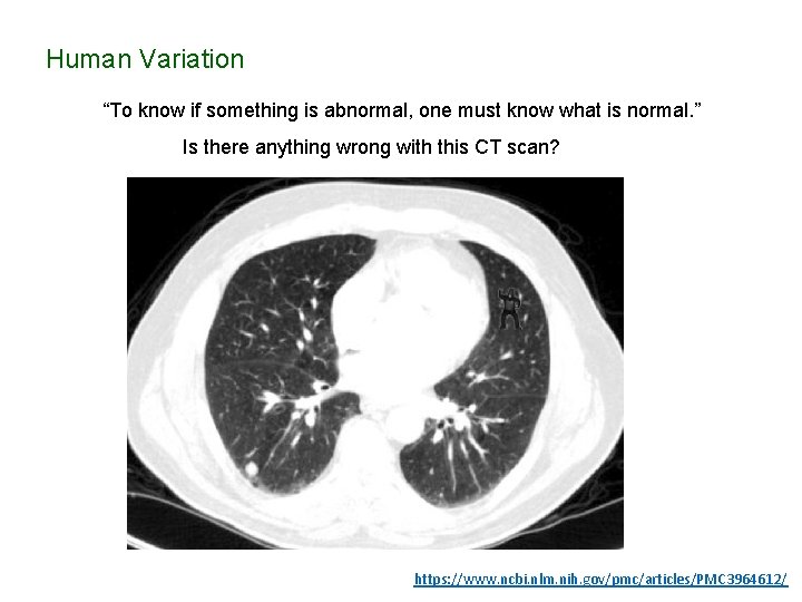 Human Variation “To know if something is abnormal, one must know what is normal.