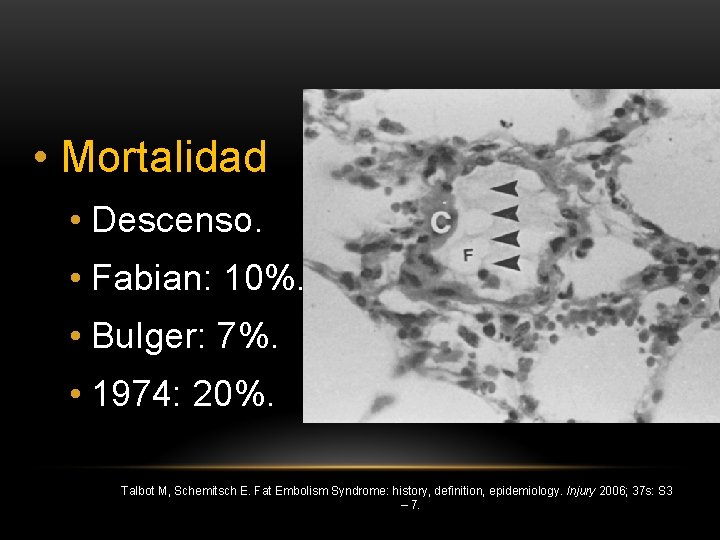  • Mortalidad • Descenso. • Fabian: 10%. • Bulger: 7%. • 1974: 20%.