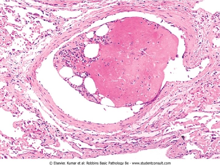 FISIOPATOLOGÍA 