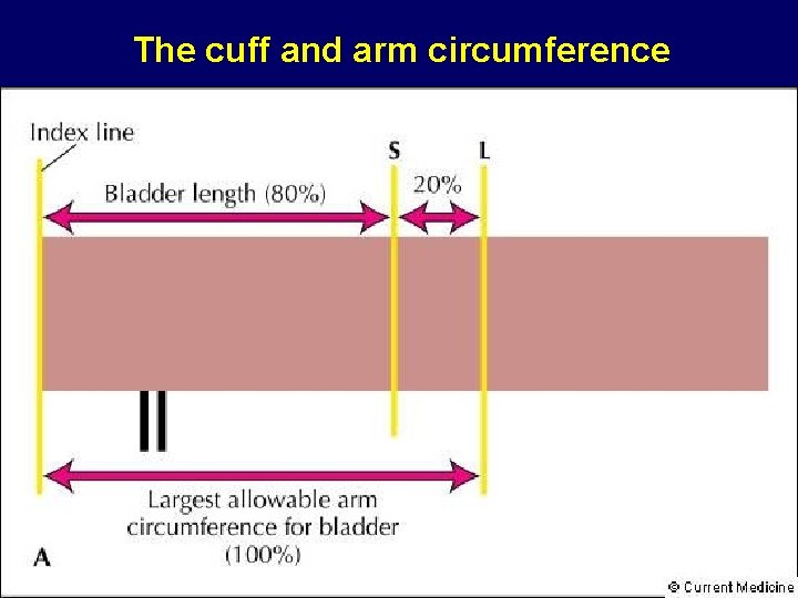 The cuff and arm circumference 