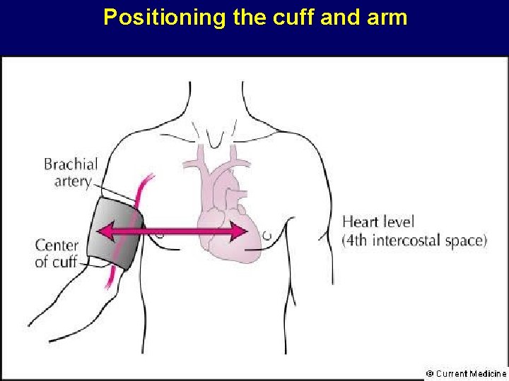 Positioning the cuff and arm 