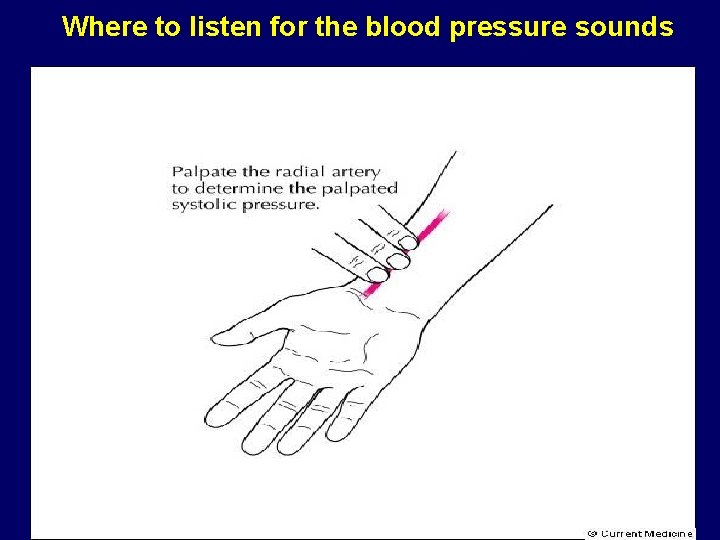 Where to listen for the blood pressure sounds 