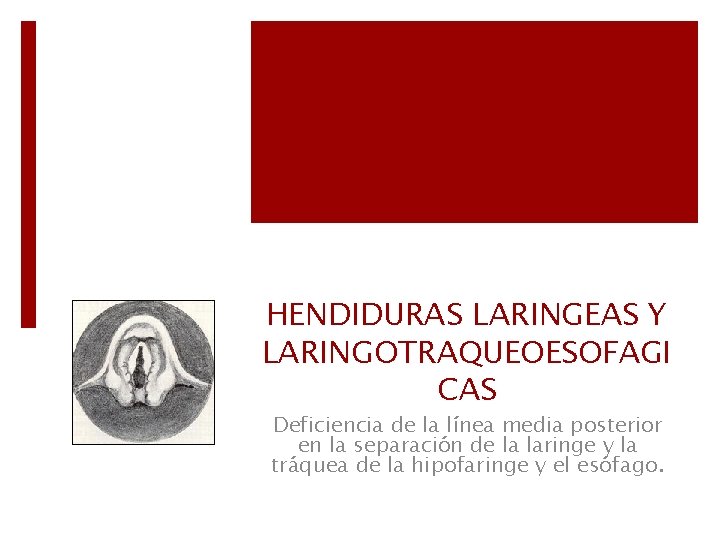 HENDIDURAS LARINGEAS Y LARINGOTRAQUEOESOFAGI CAS Deficiencia de la línea media posterior en la separación