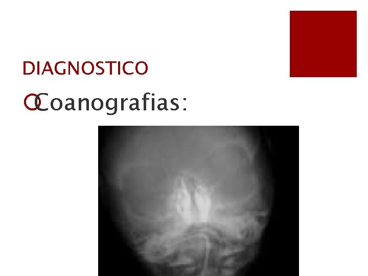 DIAGNOSTICO ¡Coanografias: 