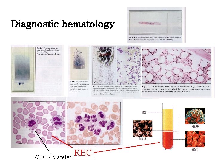 Diagnostic hematology WBC / platelet RBC 