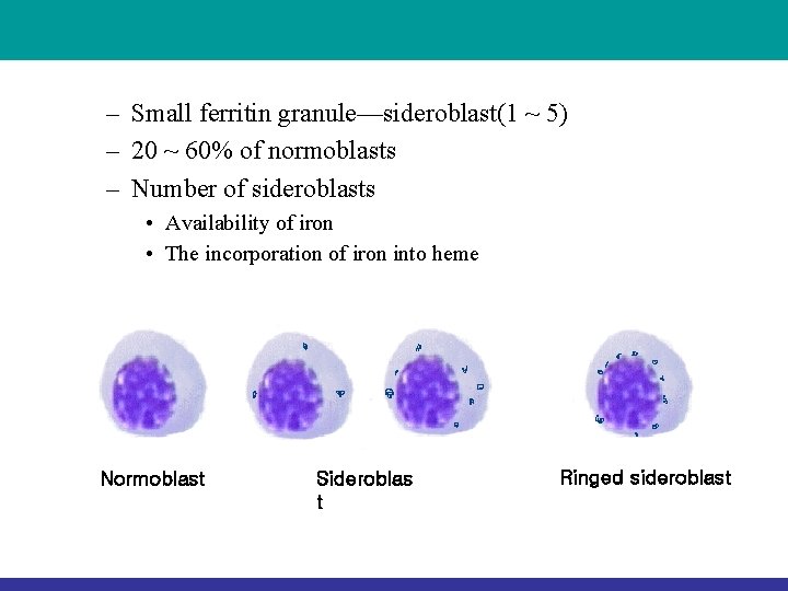 – Small ferritin granule—sideroblast(1 ~ 5) – 20 ~ 60% of normoblasts – Number – Small ferritin granule—sideroblast(1 ~ 5) – 20 ~ 60% of normoblasts – Number