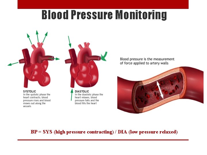 Blood Pressure Monitoring BP = SYS (high pressure contracting) / DIA (low pressure relaxed)