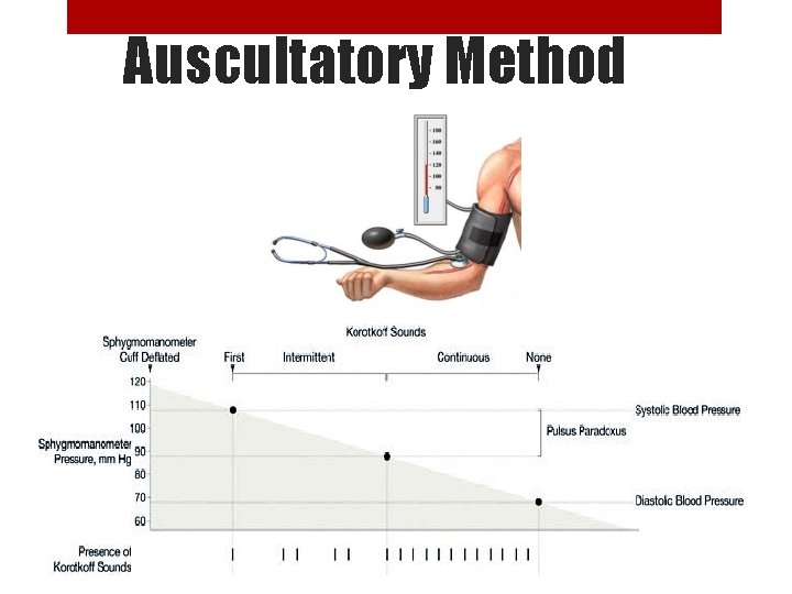 Auscultatory Method 