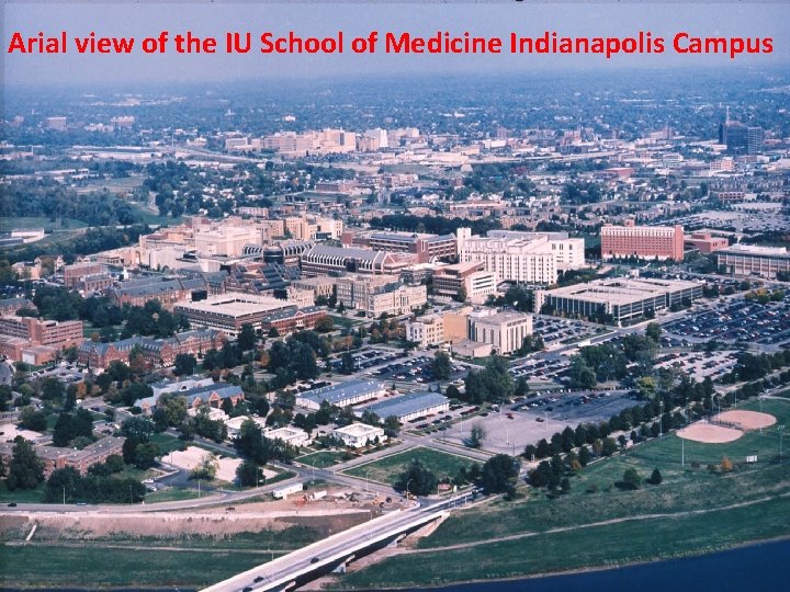 Arial view of the IU School of Medicine Indianapolis Campus 