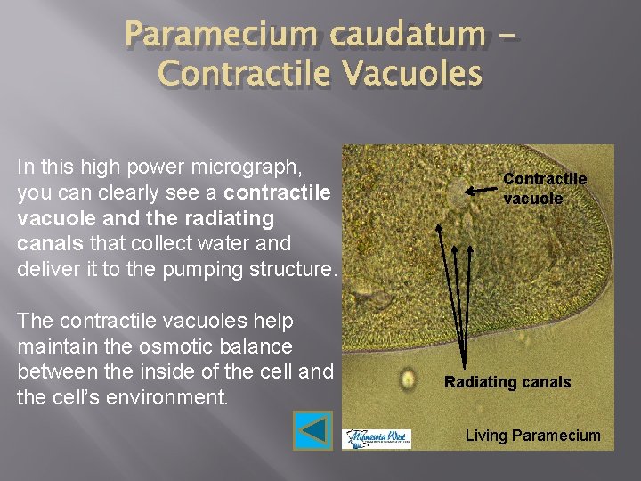 Paramecium caudatum Contractile Vacuoles In this high power micrograph, you can clearly see a