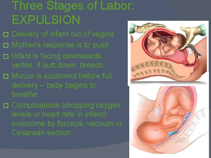 Three Stages of Labor: EXPULSION � � � Delivery of infant out of vagina