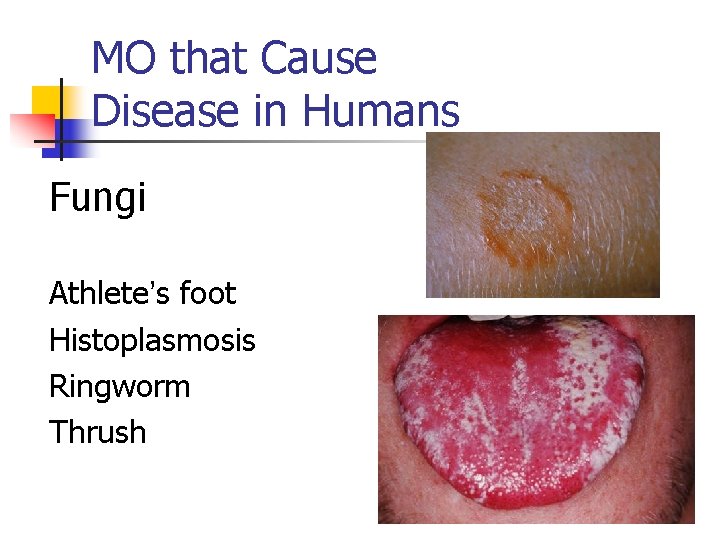 MO that Cause Disease in Humans Fungi Athlete’s foot Histoplasmosis Ringworm Thrush 