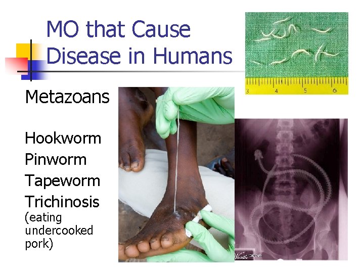 MO that Cause Disease in Humans Metazoans Hookworm Pinworm Tapeworm Trichinosis (eating undercooked pork)