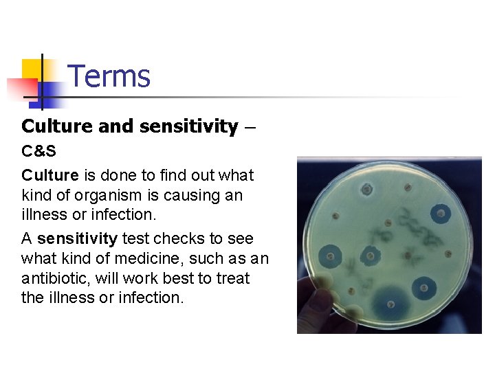 Terms Culture and sensitivity – C&S Culture is done to find out what kind