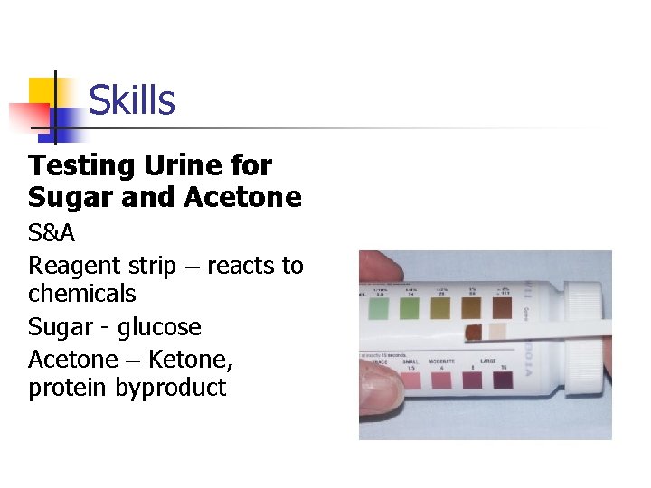 Skills Testing Urine for Sugar and Acetone S&A Reagent strip – reacts to chemicals