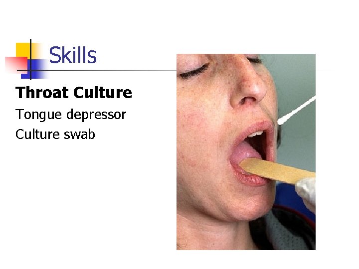 Skills Throat Culture Tongue depressor Culture swab 