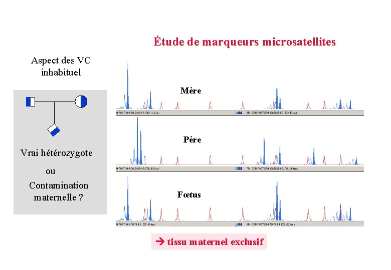 Étude de marqueurs microsatellites Aspect des VC inhabituel Mère Père Vrai hétérozygote ou Contamination