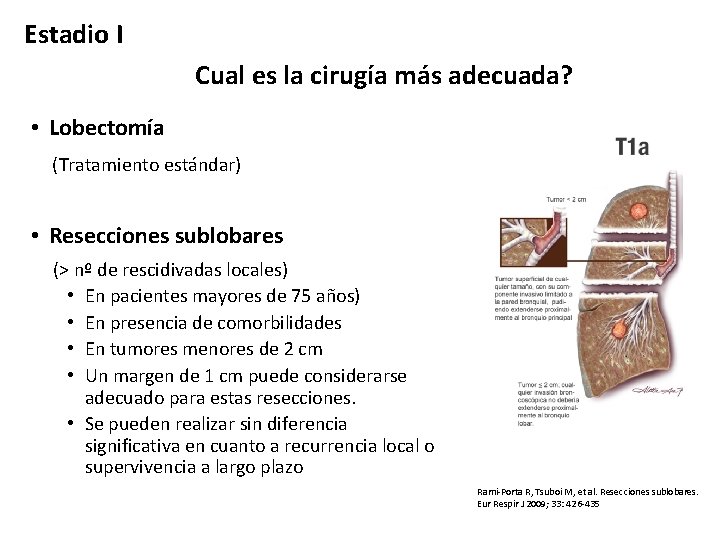 Estadio I Cual es la cirugía más adecuada? • Lobectomía (Tratamiento estándar) • Resecciones