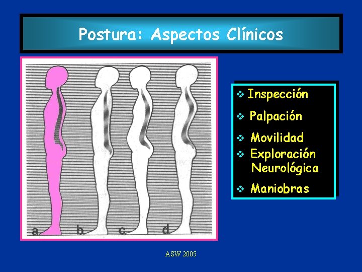 Postura: Aspectos Clínicos v Inspección v Palpación Movilidad v Exploración Neurológica v v ASW