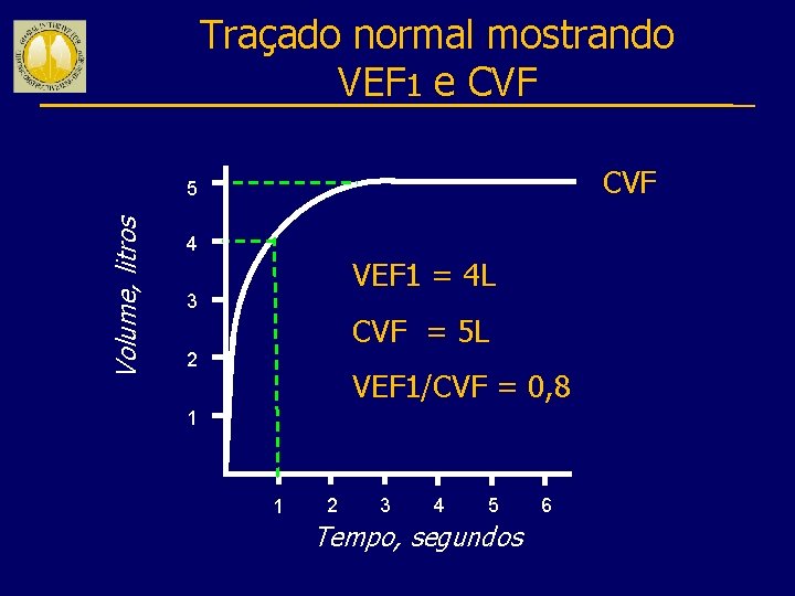 Traçado normal mostrando VEF 1 e CVF Volume, litros 5 4 VEF 1 =