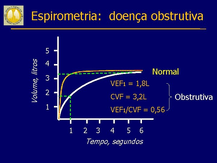 Espirometria: doença obstrutiva Volume, litros 5 4 Normal 3 VEF 1 = 1, 8