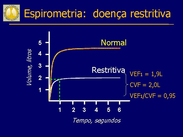 Espirometria: doença restritiva Normal Volume, litros 5 4 3 Restritiva 2 VEF 1 =