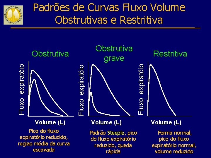 Padrões de Curvas Fluxo Volume Obstrutivas e Restritiva Obstrutiva grave Volume (L) Pico do