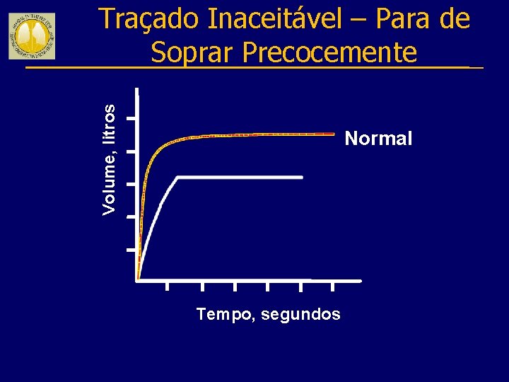 Volume, litros Traçado Inaceitável – Para de Soprar Precocemente Normal Tempo, segundos 