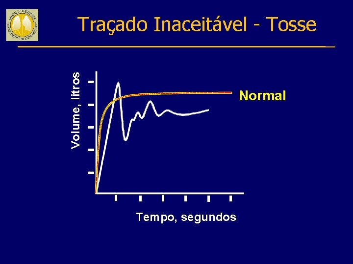 Volume, litros Traçado Inaceitável - Tosse Normal Tempo, segundos 