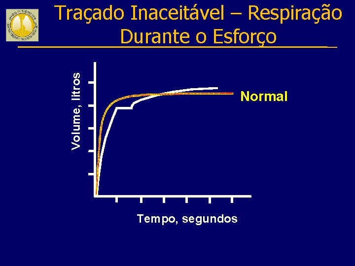 Volume, litros Traçado Inaceitável – Respiração Durante o Esforço Normal Tempo, segundos 