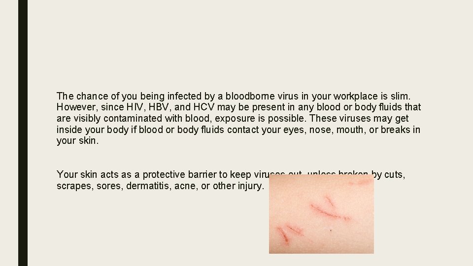 The chance of you being infected by a bloodborne virus in your workplace is